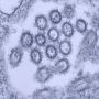 affections:infection:virus:virus_grippe_h1n1.jpg